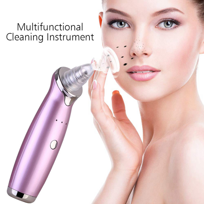 Electric Blackhead Remover with Diamond Dermabrasion and Pore Vacuum Suction