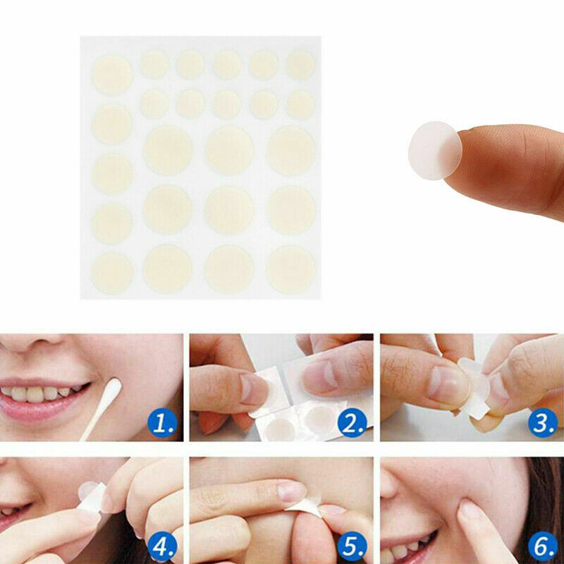 48 PCS Skin Tag & Acne Patch - Esellertree