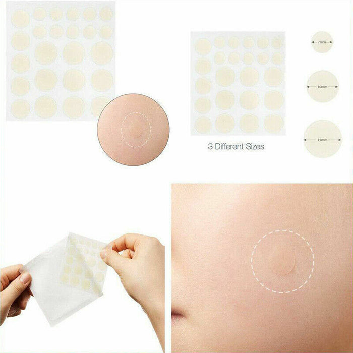 48 PCS Skin Tag & Acne Patch - Esellertree