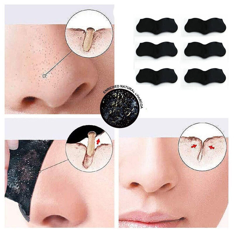 10x Nose Pore Deep Cleansing Strips Blackhead Remover Peel Off Mask Nose Sticker - Esellertree