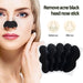 10x Nose Pore Deep Cleansing Strips Blackhead Remover Peel Off Mask Nose Sticker - Esellertree