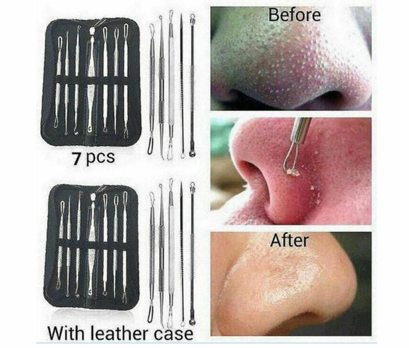 PIMPLE POPPER TOOL BLACKHEAD REMOVER KIT SPOT ACNE COMEDONE EXTRACTOR COMEDON - Esellertree