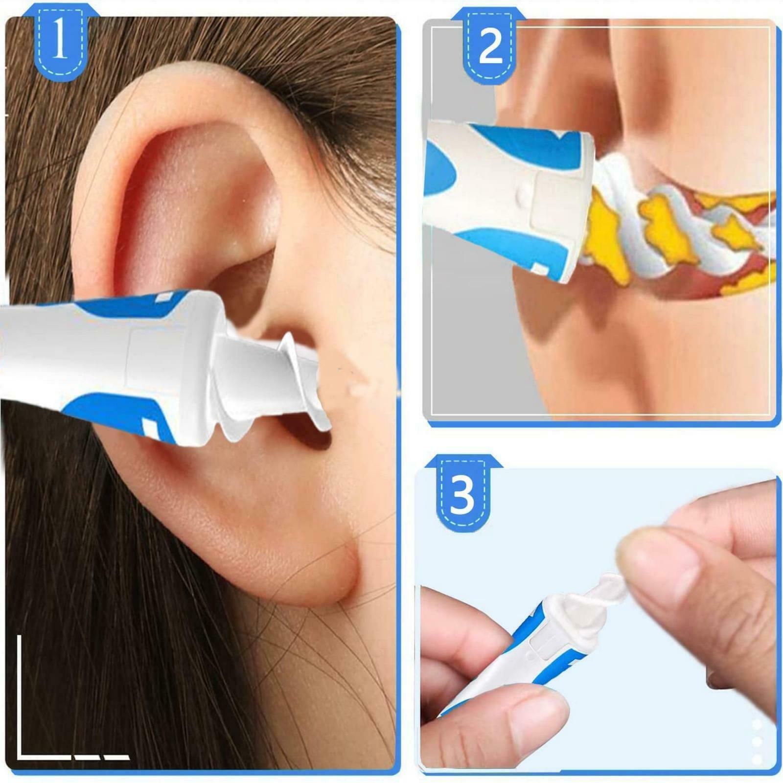 Ear Wax Remover Cleaner Soft Spiral Earwax Smart Removal Set - Esellertree