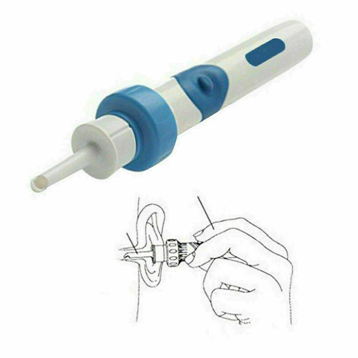 EAR WAX REMOVER Electric Ear Vacuum Cleaner Suction Earwax Remover UK - Esellertree